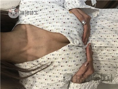 南京美贝尔黄名斗隆胸案例价格分享,变身性感女神婚后生活真美好~