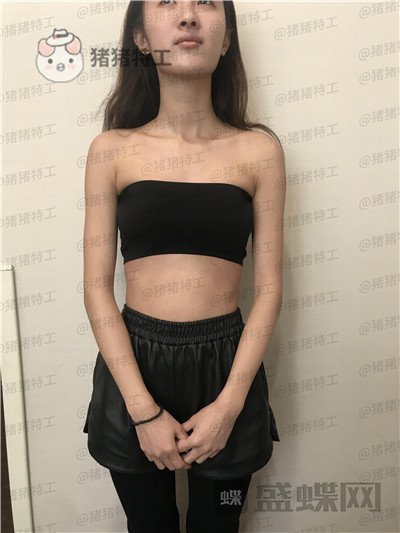 南京美贝尔黄名斗隆胸案例价格分享,变身性感女神婚后生活真美好~