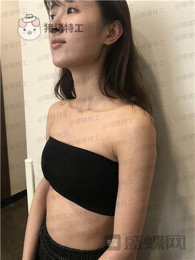 南京美贝尔黄名斗隆胸案例价格分享,变身性感女神婚后生活真美好~