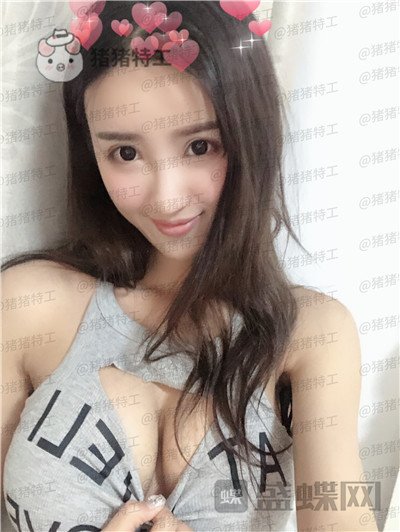 南京美贝尔黄名斗隆胸案例价格分享,变身性感女神婚后生活真美好~