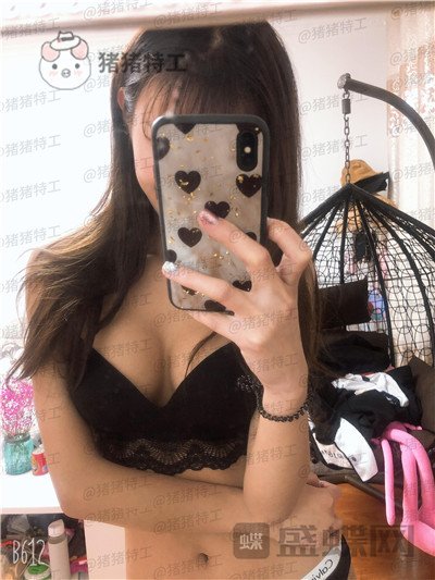 南京美贝尔黄名斗隆胸案例价格分享,变身性感女神婚后生活真美好~