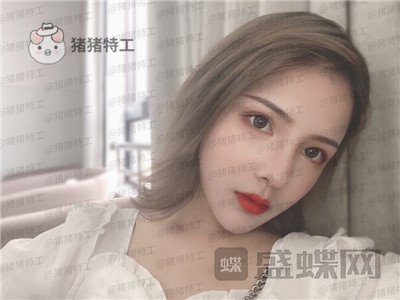 上海伯思立李茂群隆鼻案例价格分享,爸妈亲戚都夸我现在有多美。