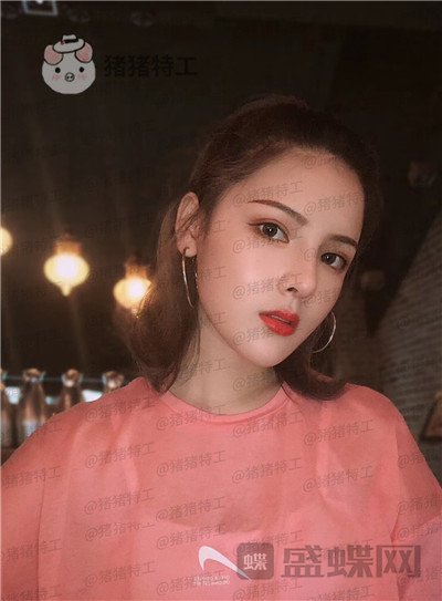 上海伯思立李茂群隆鼻案例价格分享,爸妈亲戚都夸我现在有多美。
