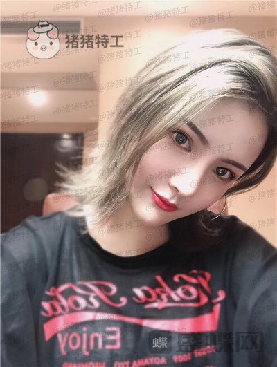 上海伯思立李茂群隆鼻案例价格分享,爸妈亲戚都夸我现在有多美。