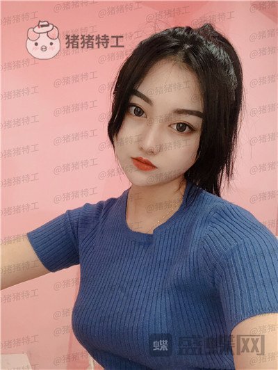 宁波珈禾费安军双眼皮案例价格分享,单眼皮但很大做完双眼皮果你懂得。