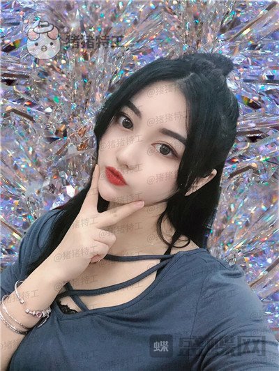 宁波珈禾费安军双眼皮案例价格分享,单眼皮但很大做完双眼皮果你懂得。