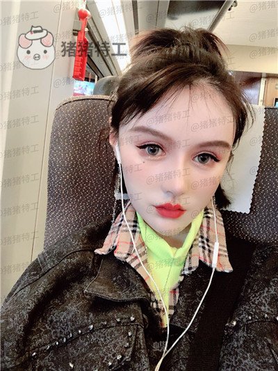 重庆精美田永华鼻部手术案例价格分享,短发女孩配好看的鼻子精致感get~