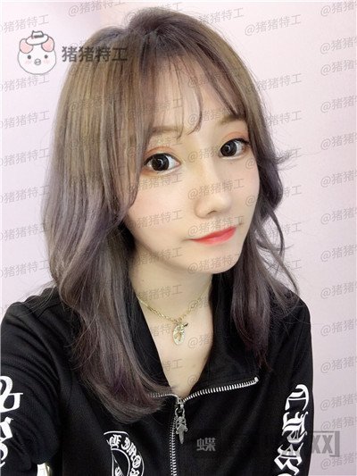武汉希思特陈安云鼻部手术案例价格分享,好洋气的鼻子哈哈整个人气质都变高级了!