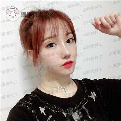 武汉希思特陈安云鼻部手术案例价格分享,好洋气的鼻子哈哈整个人气质都变高级了!