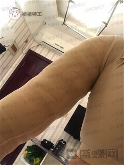 上海欧莱吸脂案例价格分享,手臂粗显壮一次性解决。