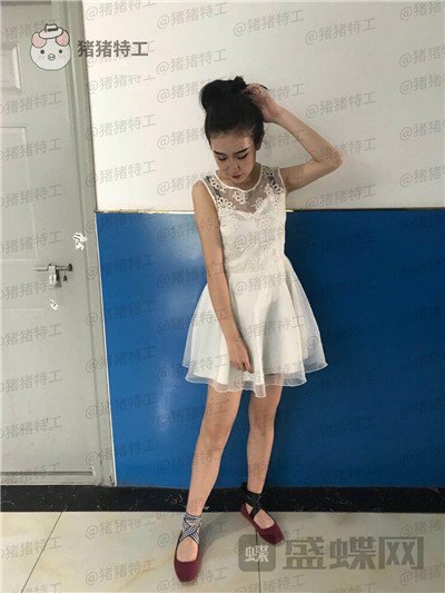 上海欧莱吸脂案例价格分享,手臂粗显壮一次性解决。