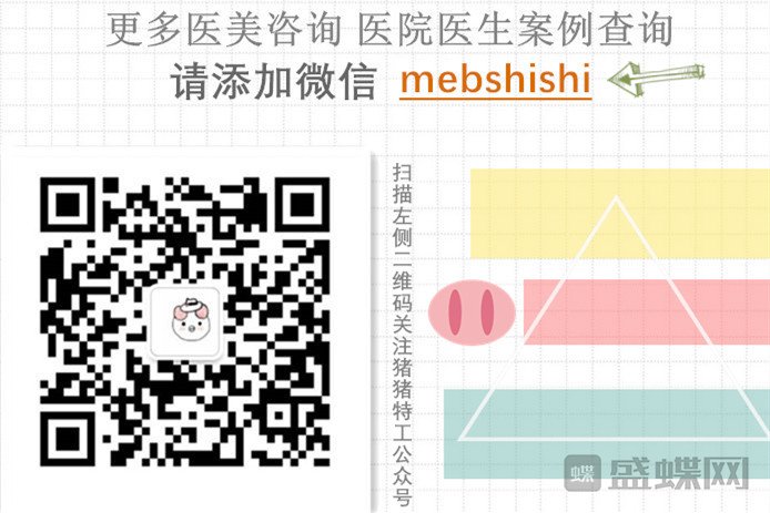 深圳恒生肖添有颧骨整形案例价格分享,颧骨高克夫?现在年轻又可爱。