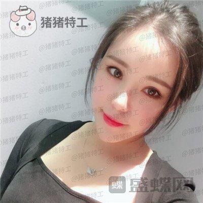 重庆百达丽黄伟光面部填充案例价格分享,想年轻就是这么简单~