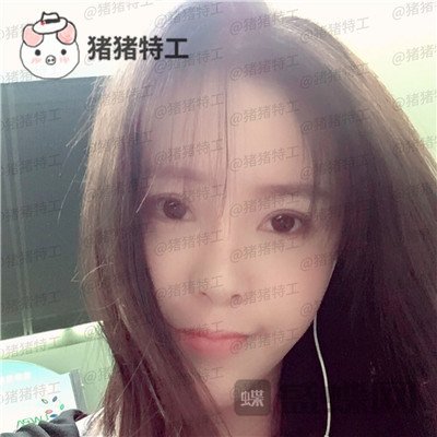 重庆百达丽黄伟光面部填充案例价格分享,想年轻就是这么简单~