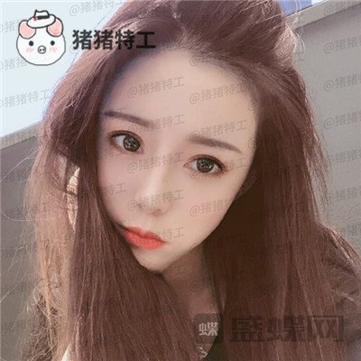重庆百达丽黄伟光面部填充案例价格分享,想年轻就是这么简单~
