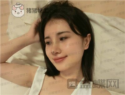 长春艾尔丽赵广文鼻部手术案例价格分享,做了鼻子改变了我的人生~
