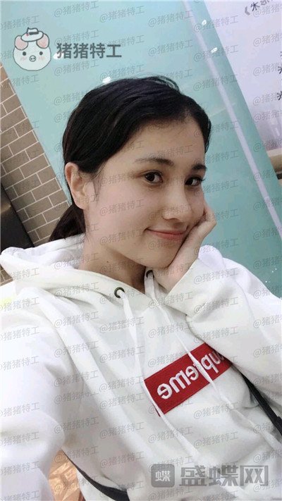 长春艾尔丽赵广文鼻部手术案例价格分享,做了鼻子改变了我的人生~