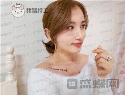 长春艾尔丽赵广文鼻部手术案例价格分享,做了鼻子改变了我的人生~