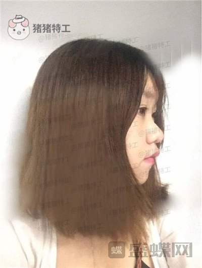 重庆玺悦台蒋福明面部吸脂案例价格分享,像娃娃一样的美少女你见过吗?