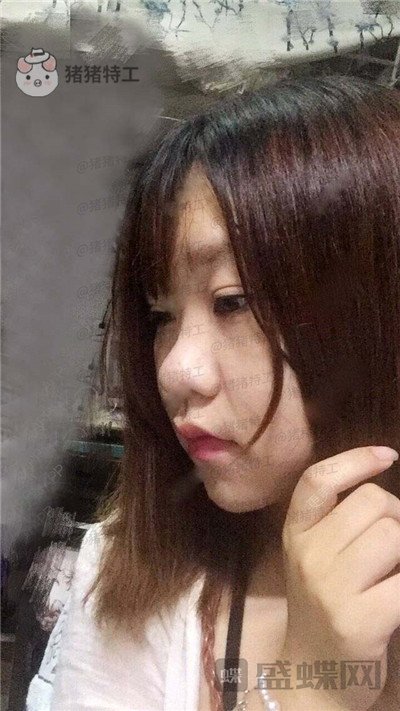 重庆玺悦台蒋福明面部吸脂案例价格分享,像娃娃一样的美少女你见过吗?