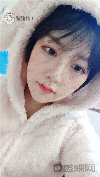 重庆玺悦台蒋福明面部吸脂案例价格分享,像娃娃一样的美少女你见过吗?