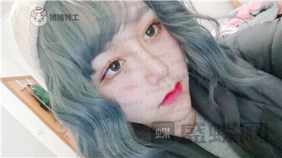 重庆玺悦台蒋福明面部吸脂案例价格分享,像娃娃一样的美少女你见过吗?