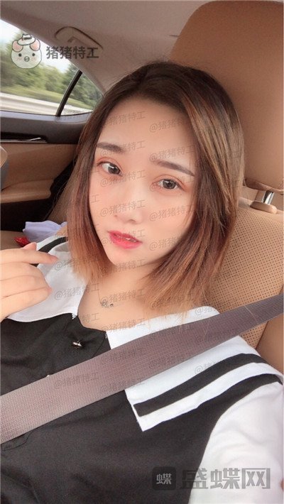 杭州格莱美王馨婉双眼皮案例价格分享,很可爱的眼睛真的好感度倍增~