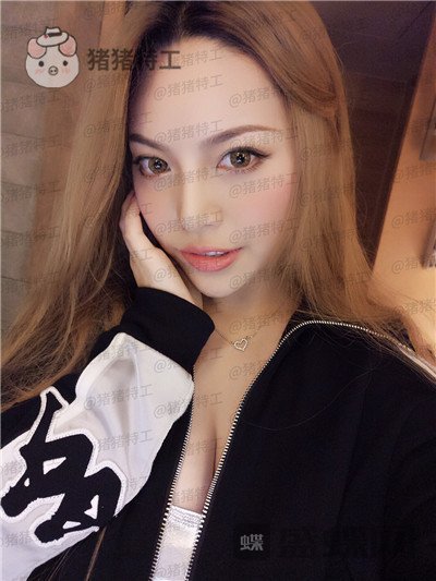 成都格莱丽王伟鼻部手术案例价格分享,做了鼻子的小姐姐混血感十足~