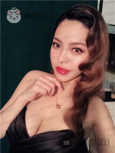 成都格莱丽王伟鼻部手术案例价格分享,做了鼻子的小姐姐混血感十足~