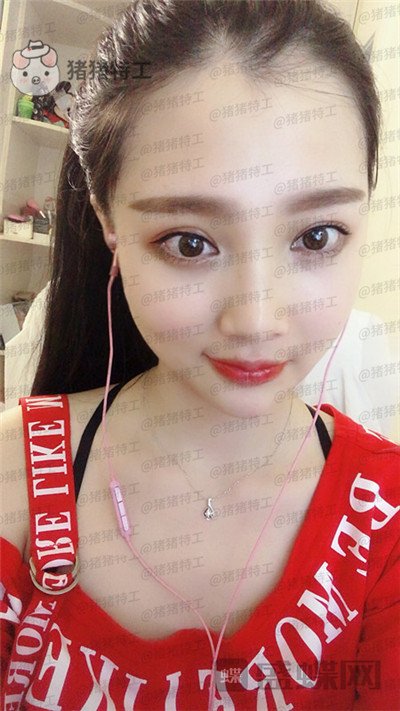 四川友谊张立天颧骨整形案例价格分享,阿姨变小仙女蜕变的很惊艳~