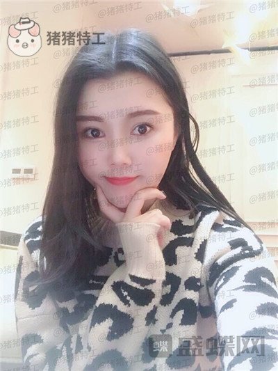 长沙凯莱肖立卫面部吸脂案例价格分享,脸不只是笑了一丁半点!
