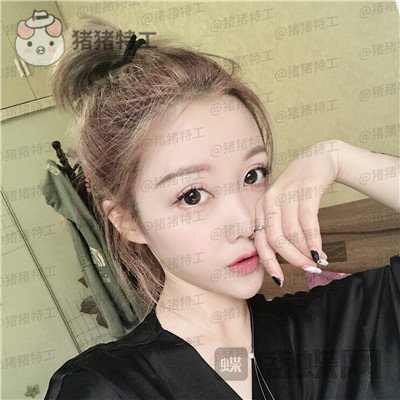 重庆铂生郝荣涛双眼皮案例价格分享,本身就是小仙女做完自带光环~