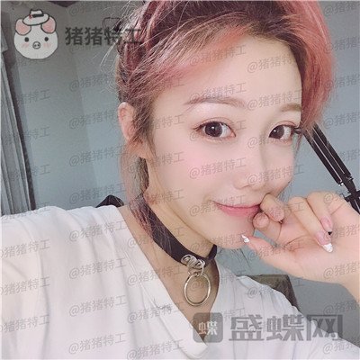 重庆铂生郝荣涛双眼皮案例价格分享,本身就是小仙女做完自带光环~