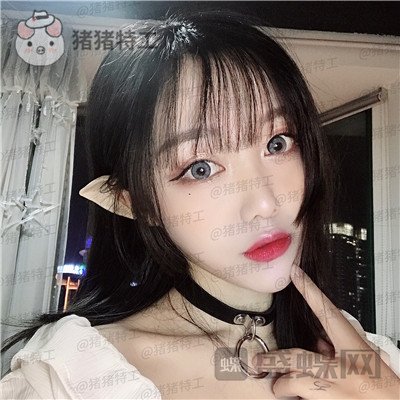 重庆铂生郝荣涛双眼皮案例价格分享,本身就是小仙女做完自带光环~