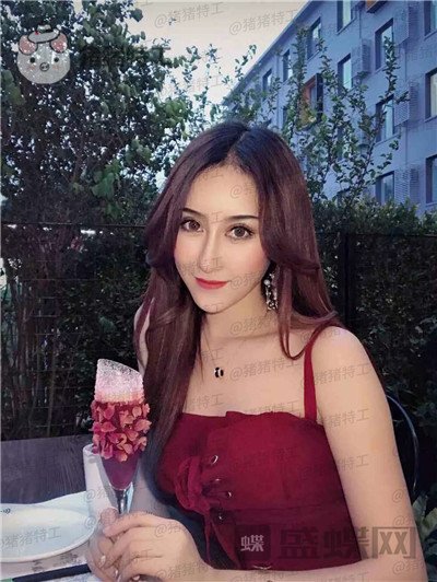 北京长虹于志宏隆鼻案例价格分享,我就是喜欢混血网红风没什么毛病