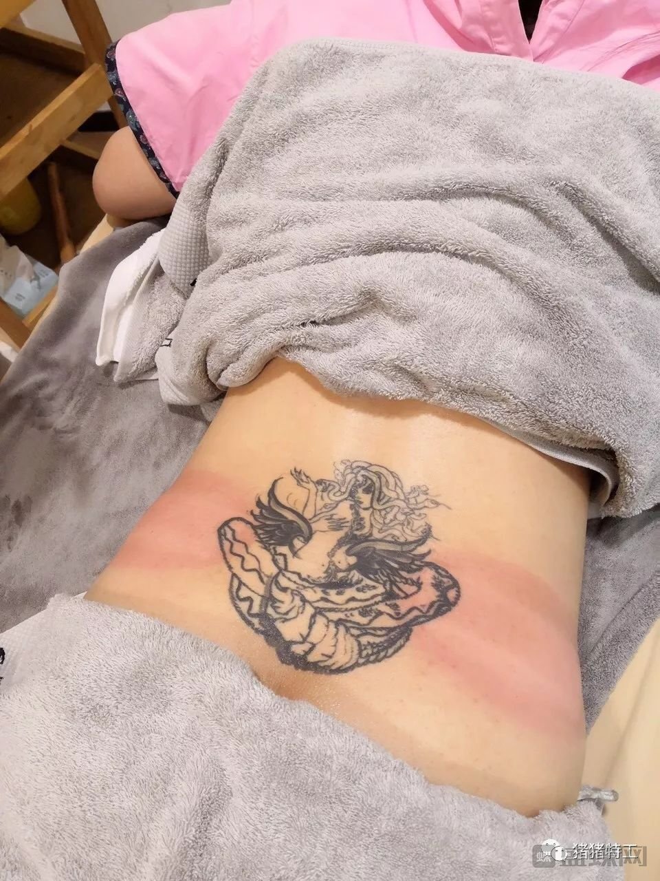 冷冻溶脂热立塑到底怎么样?价格案例分享