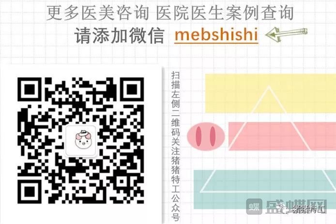 冷冻溶脂热立塑到底怎么样?价格案例分享