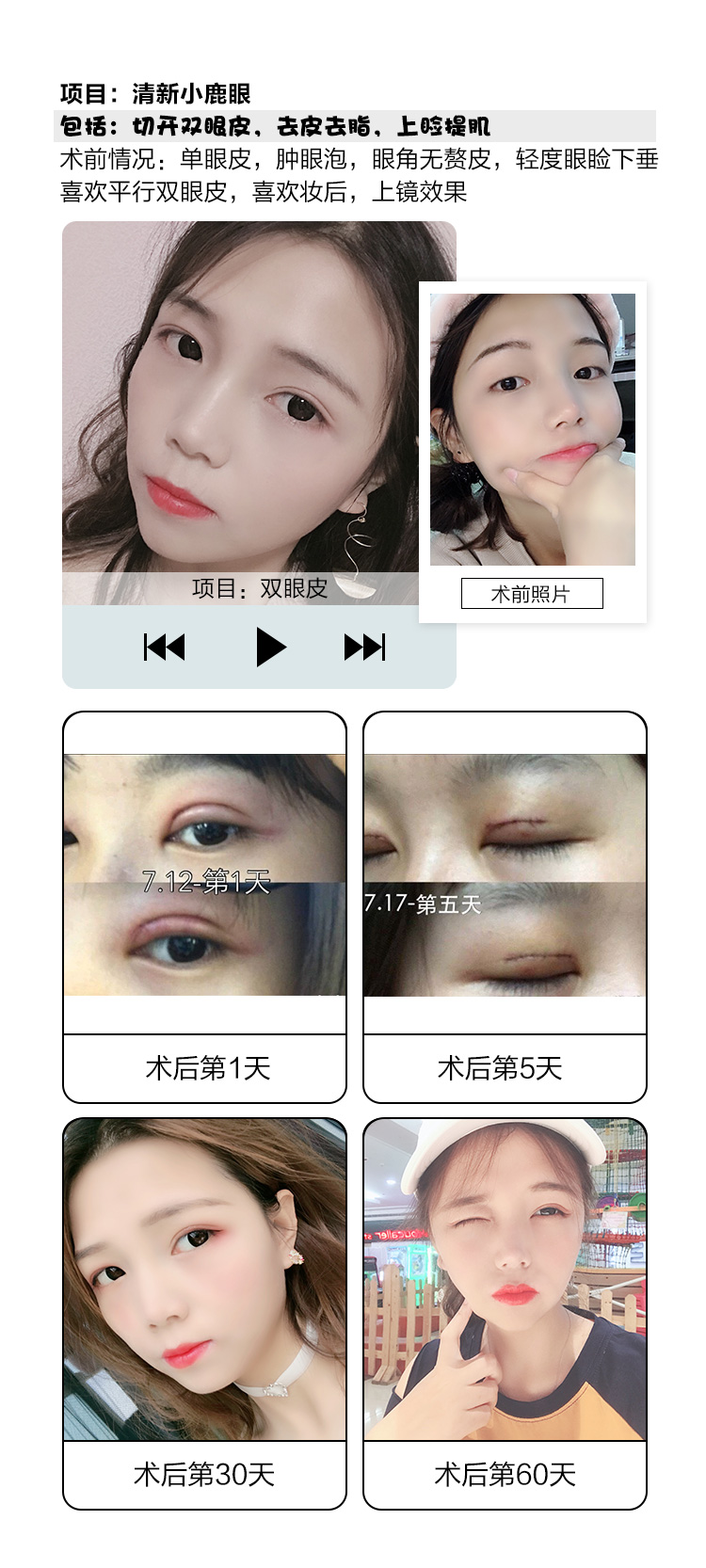 清卧蚕和眼袋有什么不同?