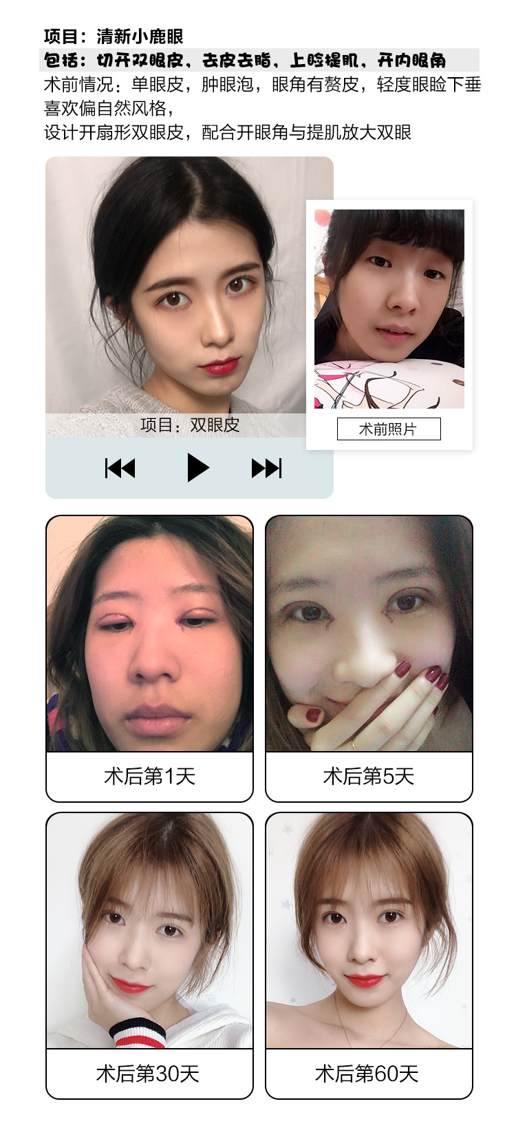 清卧蚕和眼袋有什么不同?