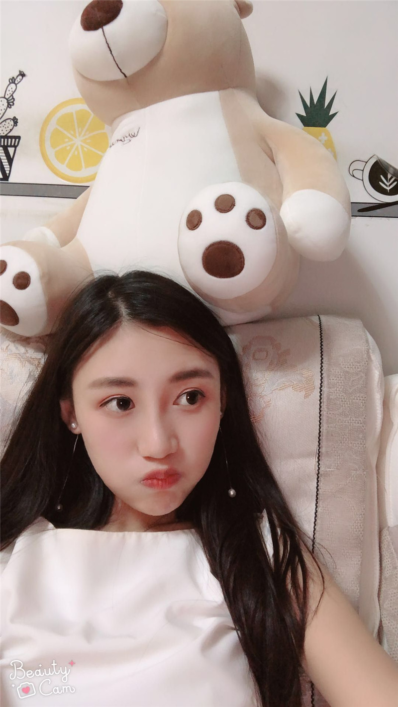 南京美贝尔整形医院黄名斗双眼皮怎么样?案例