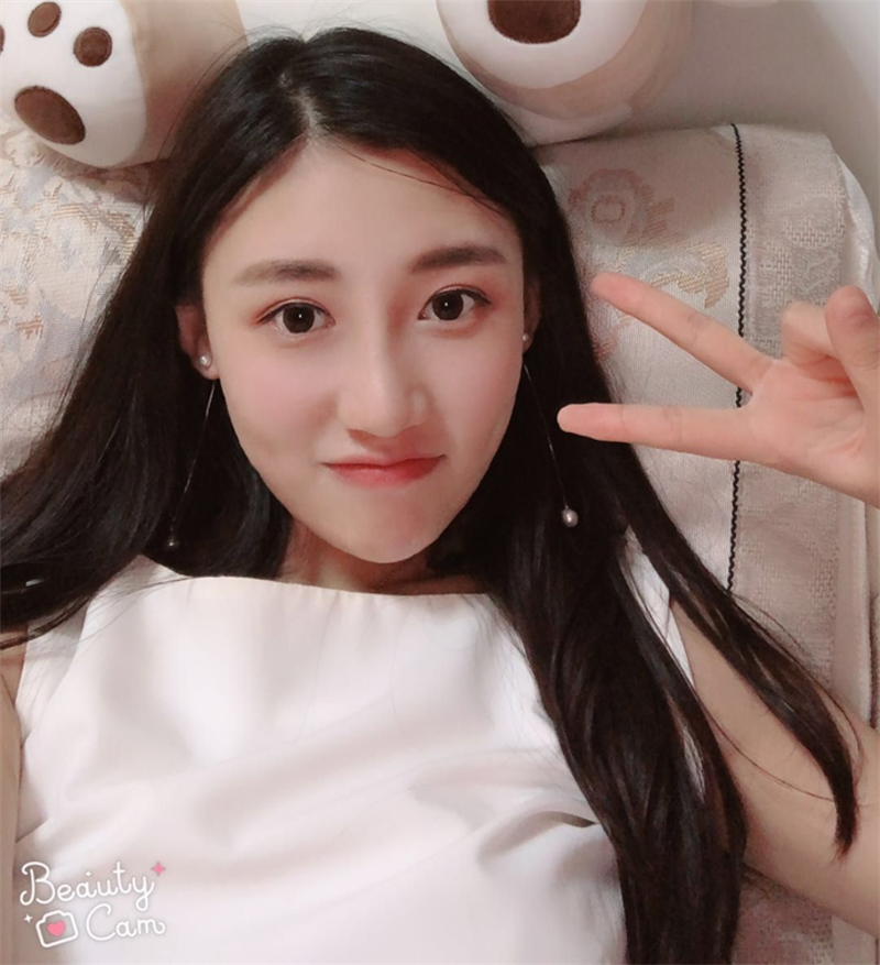 南京美贝尔整形医院黄名斗双眼皮怎么样?案例