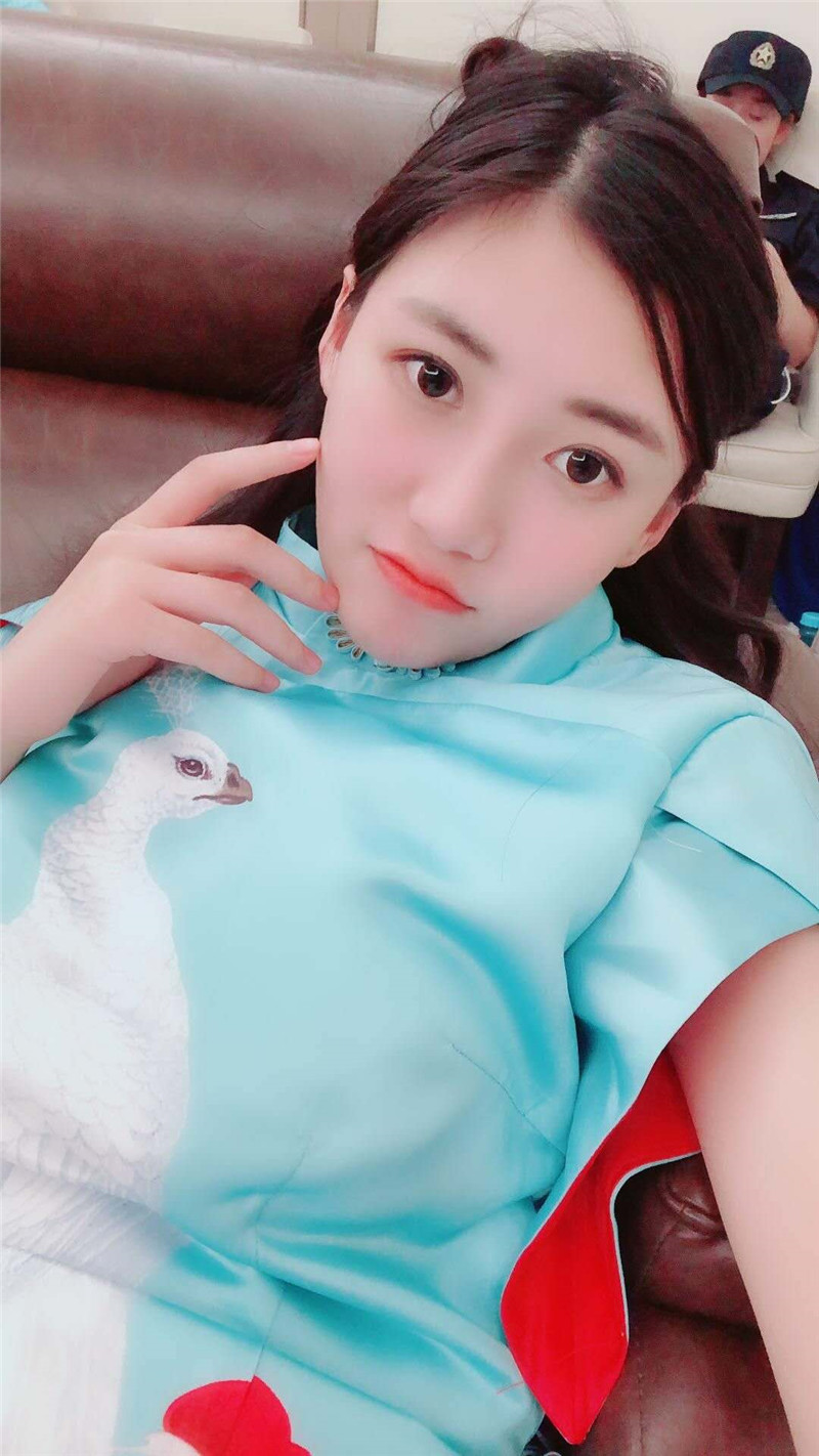 南京美贝尔整形医院黄名斗双眼皮怎么样?案例