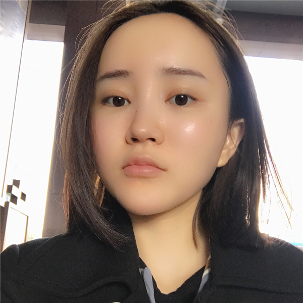 青岛亚美妍安翔自体脂肪全脸填充怎么样?案例