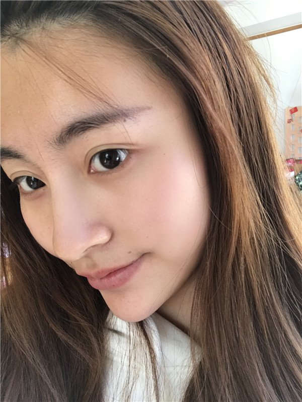 广东画美谢少玲镭射净肤怎么样?价格案例