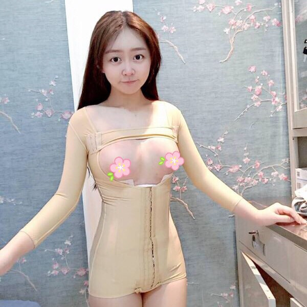 深圳颜美翟万性吸脂隆胸怎么样,价格案例