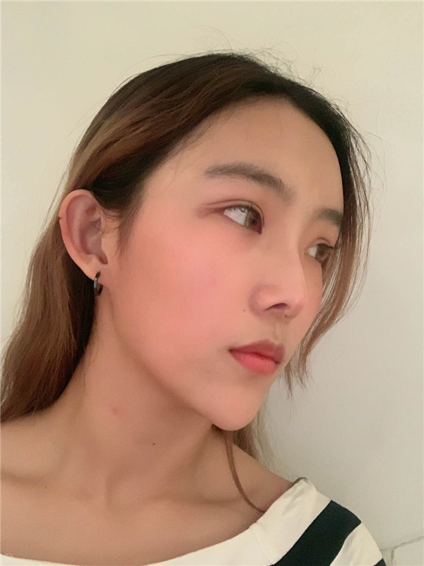 上海翡立思唐为东脂肪填充怎么样?价格案例