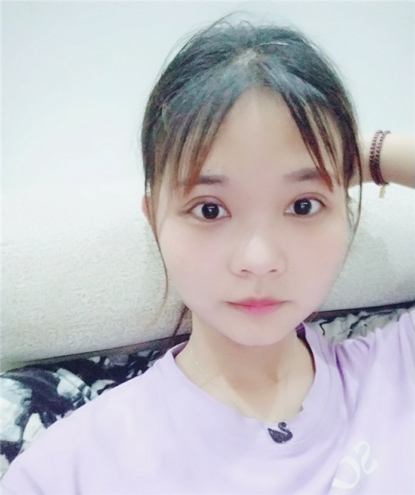 宜昌奥莱沈涵双眼皮怎么?价格案例