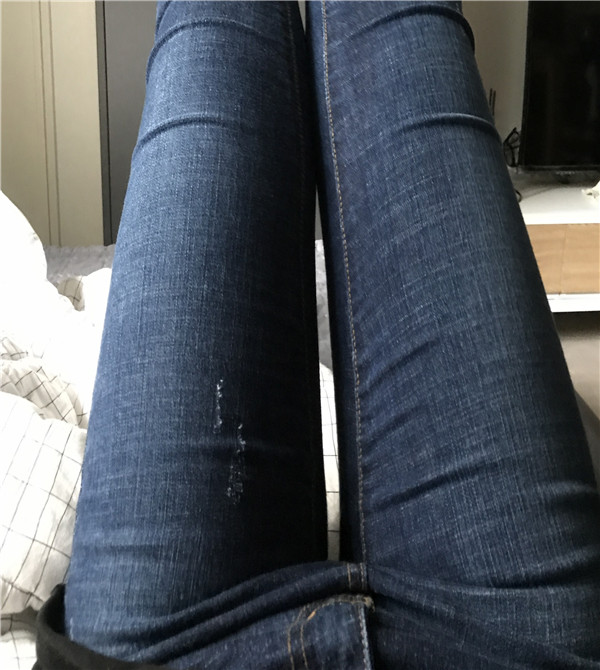 维摩整形外科姜在九吸脂怎么样?价格案例
