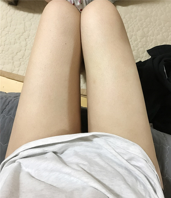 维摩整形外科姜在九吸脂怎么样?价格案例