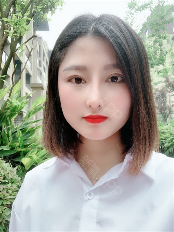 重庆铂生杜亚旭隆鼻双眼皮怎么样?价格案例